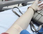Đà Nẵng: 27 người nằm viện vì ngộ độc sau khi ăn bánh mì