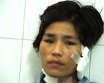 Chồng thừa nhận đánh đập, cắt tai vợ cũ do mâu thuẫn tiền bạc