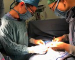 Nối thành công tá tràng đứt rời cho bé sơ sinh