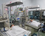 Thành công phẫu thuật tách rời hai bé gái dính nhau phần gan