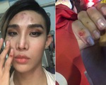 Người mẫu The Face tố bị tài xế Go Viet 