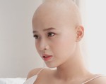 Nữ sinh bị ung thư đi thi duyên dáng