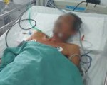 Cứu sống bệnh nhân đột ngột ngưng tim ngưng thở từ tay 