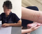 Một thiếu nữ tố bị hiếp dâm trong 2 năm ở Trung tâm bảo trợ xã hội tỉnh Bình Dương
