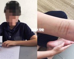 Yêu cầu xử lý vụ thiếu nữ tố bị hiếp dâm ở Trung tâm bảo trợ xã hội Bình Dương