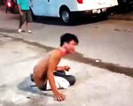 Em trai bị chị ruột tưới nguyên bình nước sôi lên người