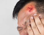 7 dấu hiệu cho thấy bạn cần đi cấp cứu sau một chấn thương đầu