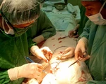 Bệnh viện Ung bướu TP.HCM đã thử nghiệm ứng dụng trí tuệ nhân tạo trị ung thư