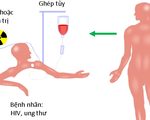 Chữa hết HIV nhờ người đột biến gen