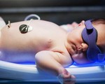 Biểu hiện vàng da ở trẻ sơ sinh báo hiệu bệnh lý nguy hiểm