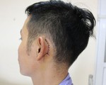 Điện thoại phát nổ khi sạc, phải mổ vá màng nhĩ