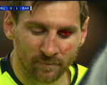 Messi đổ máu trong chiến thắng của Barca trước MU