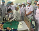Lọc máu cứu sống bệnh nhi mắc tay chân miệng biến chứng