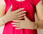Xử lý phù tay sau điều trị ung thư vú
