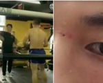 Video võ sư Trung Quốc lén "chọc vào mắt" võ sĩ MMA sau khi đánh thua