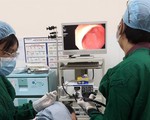 Viêm dạ dày có chuyển sang ung thư?