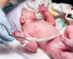 Lấy tế bào gốc từ máu cuống rốn: những điều cần biết