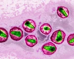 Giới khoa học đã ở rất gần cách chữa bệnh HIV/AIDS