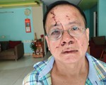 Một Việt kiều Đức bị nhóm thanh niên đánh tại quán karaoke ở TP.HCM
