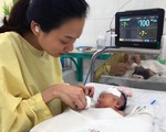 Cứu sống bé gái sinh non tắc tá tràng bẩm sinh