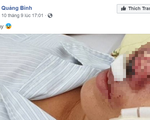 Quảng Bình bác tin đồn có bệnh nhân nhiễm "vi khuẩn ăn thịt người" Whitmore