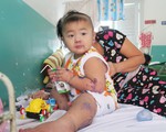 Gia tăng trẻ bị bệnh tay chân miệng tại TP. Hồ Chí Minh