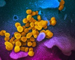 Virus corona chủng mới trông ra sao dưới kính hiển vi?
