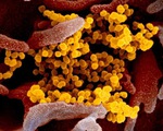 Vì sao nói chủng mới virus corona ở Trung Quốc bất thường?