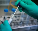 Thêm 7 người nhiễm virus gây COVID-19, Việt Nam đã có 113 ca bệnh