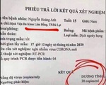 Xác minh người làm giả phiếu xét nghiệm dương tính virus corona tung lên mạng câu view