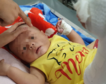Bé trai 4 tháng tuổi gãy xương, xuất huyết não, bầm nhiều chỗ, người nhà nói 