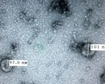 Việt Nam nuôi cấy và phân lập thành công virus corona mới