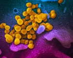Nga giải mã thành công bộ gene virus corona gây bệnh COVID-19