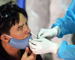 Mũi hay họng chứa nhiều virus SARS-CoV-2 hơn?