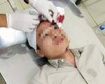 Nhóm côn đồ cầm dao vào trạm Cù Đinh đánh một kiểm lâm viên nhập viện