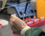 Xét nghiệm thấy virus corona cả khi người nhiễm chưa phát bệnh