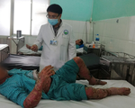 Khắp người sưng phù, nứt nẻ vì thuốc trị vảy nến mua trên mạng