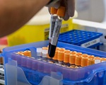 Phát hiện mới: Người nhóm máu O có sức đề kháng tốt hơn với virus corona