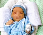 Bé sơ sinh bị bỏ rơi hơn 40 giờ nghi bị nhiễm trùng máu, bác sĩ dồn lực cứu chữa
