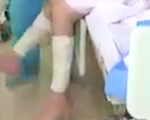 Video bệnh nhân phi công người Anh ngồi dậy, đung đưa cả hai chân