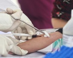 22 ca COVID-19 mới, 17 ca liên quan Đà Nẵng