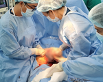Cứu sống một bé gái có khối u khổng lổ trên mặt lúc chào đời