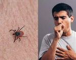 Virus lây từ bọ ve cắn làm 7 người chết, 60 người nhiễm bệnh tại Trung Quốc