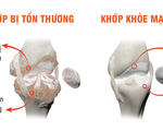 Sống tự chủ hơn nhờ chăm sóc xương khớp đúng cách