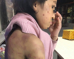 Vụ bé gái 12 tuổi bị mẹ đẻ bạo hành, người tình của mẹ cưỡng bức: Cục Trẻ em lên tiếng