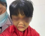 Bé gái 6 tuổi bị mẹ ruột đánh thâm tím mặt, tinh thần hoảng loạn