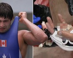Đang thi đấu, võ sĩ MMA bị xử thua 