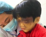 Khởi tố người mẹ ở Cẩm Giàng, Hải Dương vì bạo hành tím mặt con gái 6 tuổi