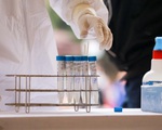 Hai cô giáo mắc COVID-19, là F1 của nữ kế toán trường học ở Điện Biên