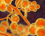 WHO công bố danh sách các loại nấm gây bệnh nhiễm trùng nguy hiểm nhất thế giới